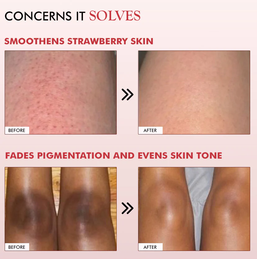 11% AHA BHA Strawberry Body Lotion for Skin Smoothening - Image 7